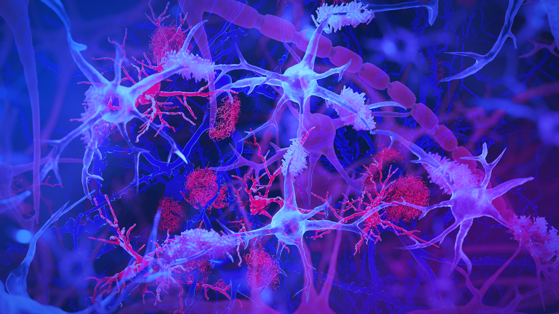 readhead-microglia-banner